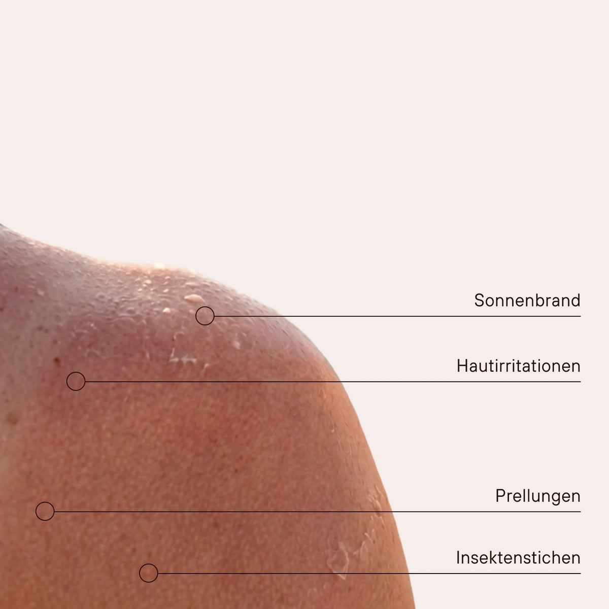 Fermented Skin Repair Spray